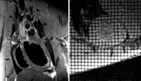 Mri Rf Coils Rf Coil Technical Details Bruker