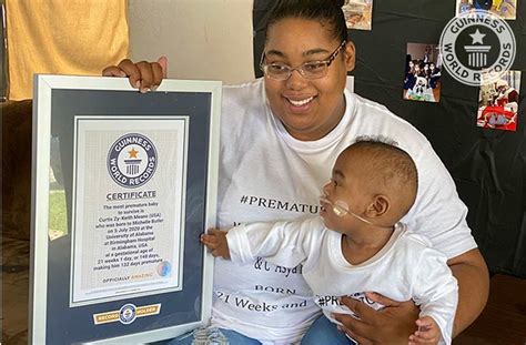 Bebê mais prematuro do mundo entra para o Guinness Book Metrópoles