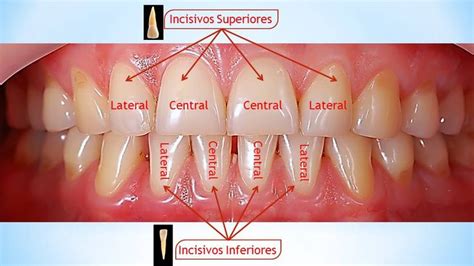 Incisivos Dentes Dentes Incisivos Nomenclatura Dos Dentes