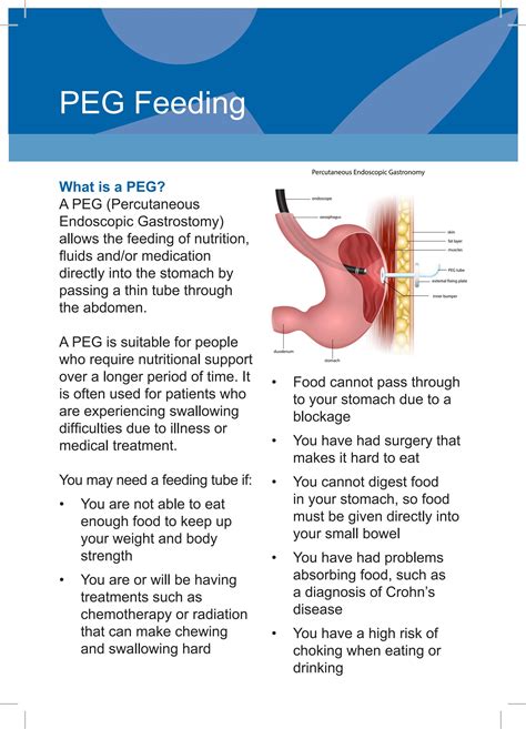 PEG Feeding by Yishun Health - Issuu