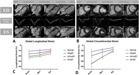 Range Variability Of Multilayer Myocardial Strain Across Different