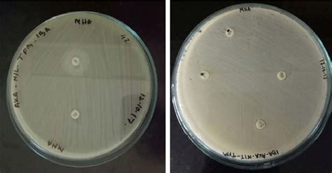 The Antibiotic Susceptibility Test Result Of Klebsiella Pneumoniae