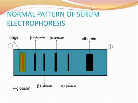 Ppt Electrophoresis And Its Importations Powerpoint Presentation