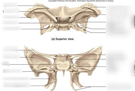 Sphenoid Bone Diagram Quizlet