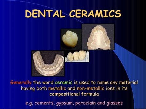 DENTAL CERAMICS Dental Porcelain All-CERAMIC RESTORATIONS dental mate…