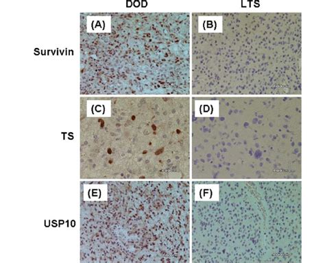 Immunohistochemical Staining For Survivin Ts And Usp On