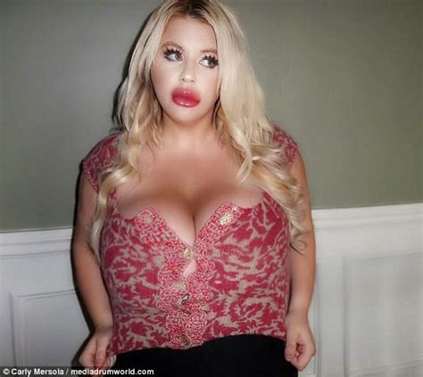 Woman Spends 50k On Plastic Surgery To Look Like Jessica Rabbit