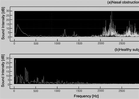 Figure 1 From Diagnostic Accuracy Evaluation Of Nasal Sound Spectral