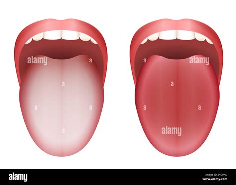 What Does A Healthy Tongue Look Like