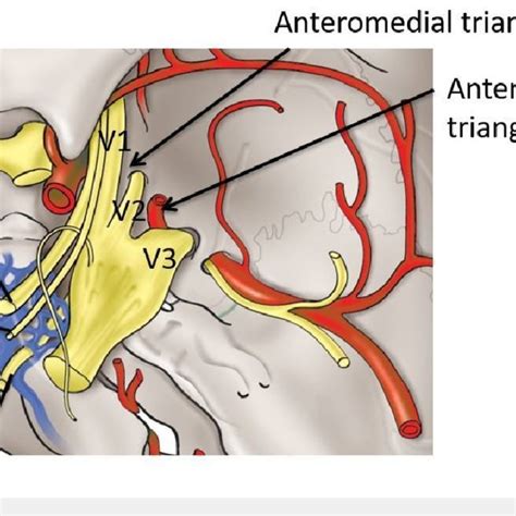 Pdf Intracranial Anatomical Triangles A Comprehensive Illustrated Review