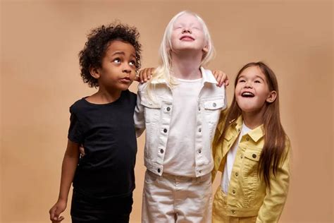 Albino african child Stock Photos, Royalty Free Albino african child ...