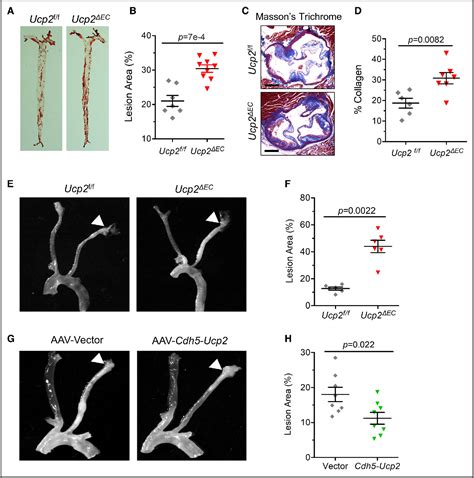 Figure From Endothelial Ucp Is A Mechanosensitive Suppressor Of