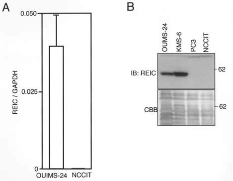 Reduced Expression Of REIC Dkk 3 In A Malignant Human Testicular Germ