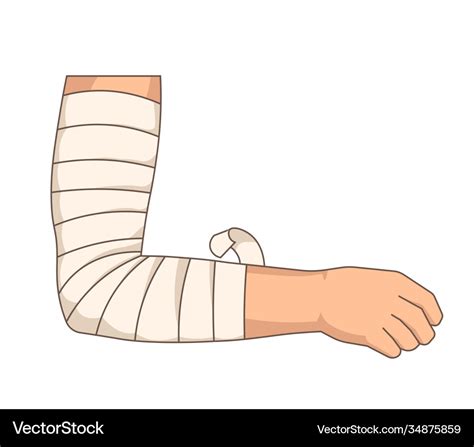 Bandage Elbow Injury Arm Bandaging Elastic Tape Vector Image