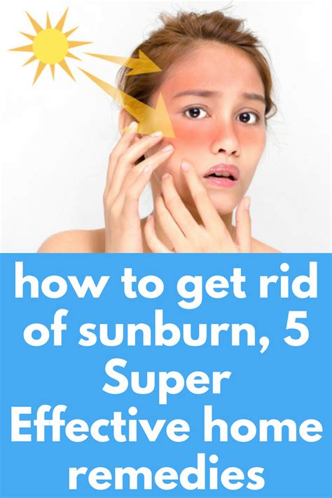 How To Get Rid Of Sunburn 5 Super Effective Home Remedies Sitting Under The Warm Sun And