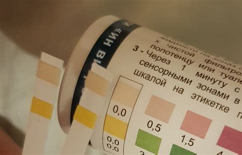 Полоски Кетоглюк - Вопросы о беременности - BabyPlan