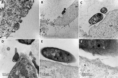 Representative Transmission Electron Micrographs Of C Jejuni Cells