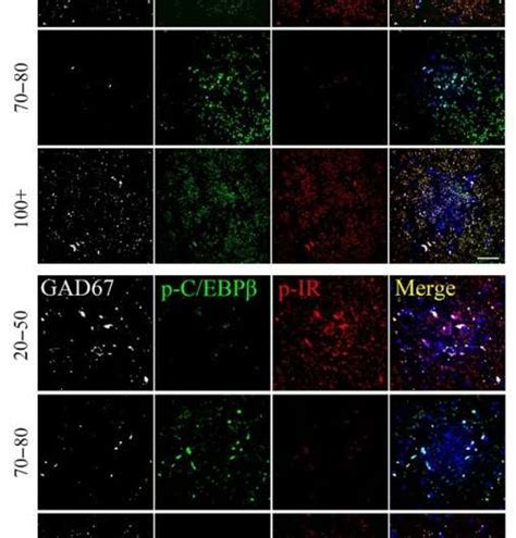 C EBPβ AEP pathway dictates both Alzheimer s disease and longevity