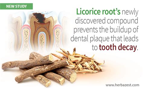 Licorice Compound Strong Against Tooth Decay Bacteria Tooth Decay Tooth Decay Treatment