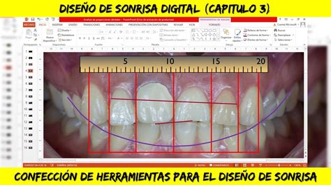 HERRAMIENTAS Diseño de Sonrisa Digital POWER POINT Cap 3 YouTube