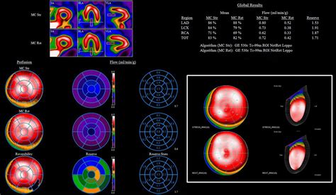 Comparative Analysis Between Myocardial Perfusion Reserve And Maximal