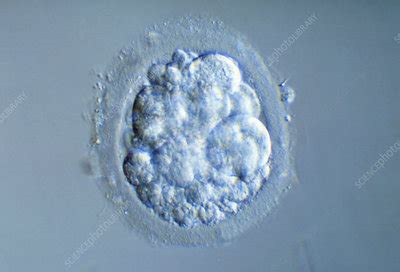 Aborting Embryo Stock Image P Science Photo Library