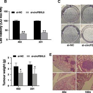 Knockdown Of CircFBXL5 Suppresses Proliferation And Migration Of Breast