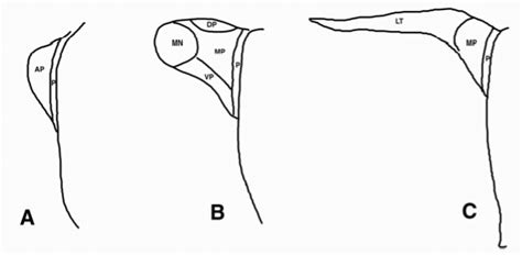 Etx Pit Ch1 Fig25 Endotext