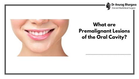 Premalignant Lesions Of The Oral Cavity