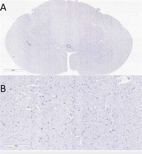 Histology Slides Database Spinal Cord Histology Slide The Best Porn