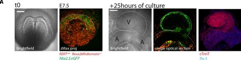 Figures And Data In Live Imaging Of Heart Tube Development In Mouse