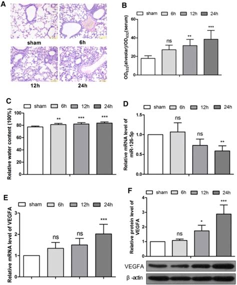 Induction Of Acute Lung Injury In Mice By Bronchial Instillation Of