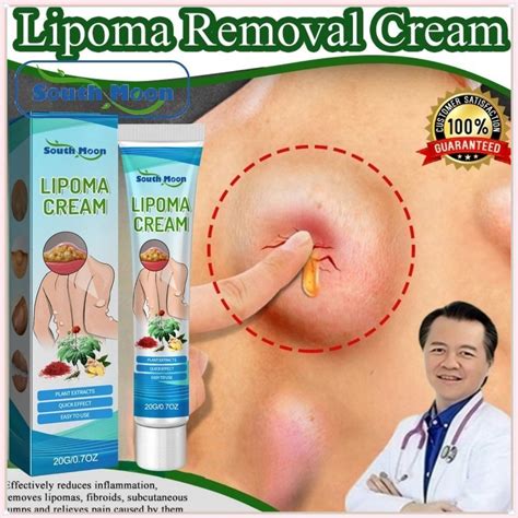 Jual South Moon Lipoma Cream Salep Benjolan Original Obat Benjolan