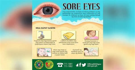 City Health Office urges safety vs sore eyes