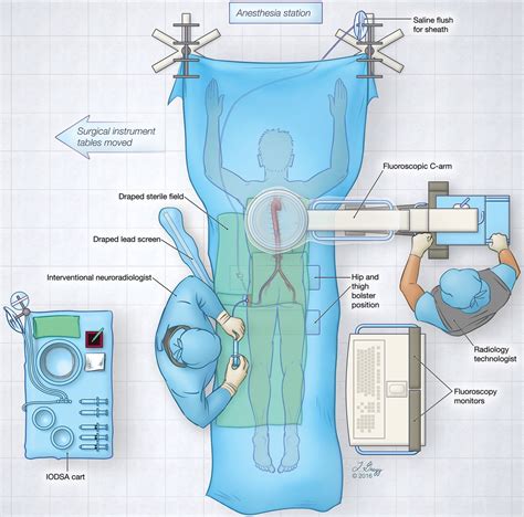 Intraoperative Spinal Digital Subtraction Angiography Indications