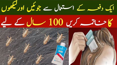 Lice In Hair Removal Lice Removal Treatment At Home Sar Ki