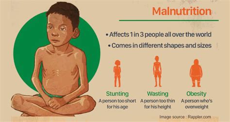 MALNUTRITION