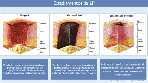 Les O Por Press O O Guia Simples E Pr Tico De Cuidados