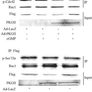 Pkg Ii Inhibits Lpa Induced Cell Migration Which Is Dependent On Rac