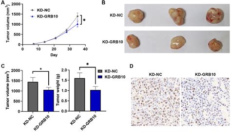 Grb Is A Novel Factor Associated With Gastric Cancer Proliferation