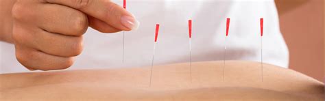 Dry Needling – ProCares Clinic