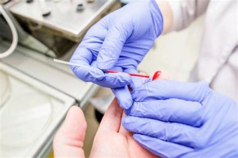 Вдохновившись пиявками, в Швейцарии создали устройство для забора крови ...