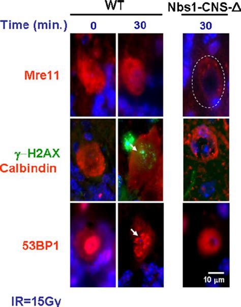 Nbs1 Deletion Attenuates DDR In Purkinje Neurons Confocal Micrographs