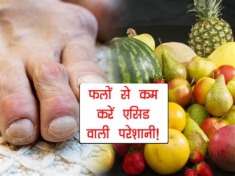 Fruits For Uric Acid Patient खून में घुल जाता है गठिया और हड्डियों की