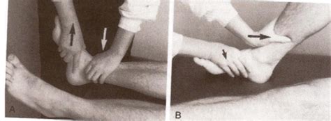 Orthopedic Treatment FT400 Module 6 Ankle And Foot Special Tests