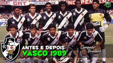 Vasco Antes E Depois Vasco Before And After Vasco Antes Y