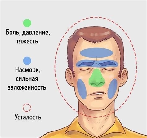 Гайморит: симптомы, причины, диагностика и лечение | Блог ЛДЦ Здоровье