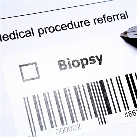 Understanding Transrectal Ultrasound-Guided Prostate Biopsy: A Vital ...