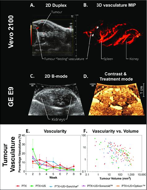 Example Ultrasound Images And Quantitative Results From Tumor