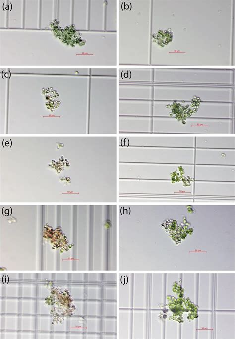 Representative microscopic images of Microcystis aeruginosa under ...